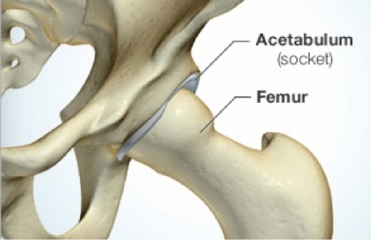 Hip Arthroscopy